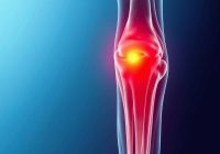 Stany zapalne ścięgien – przyczyny, objawy i skuteczne leczenie Stany zapalne ścięgien – przyczyny, objawy i skuteczne leczenie