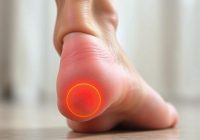 Ostroga piętowa i rehabilitacja – jak skutecznie leczyć ból?